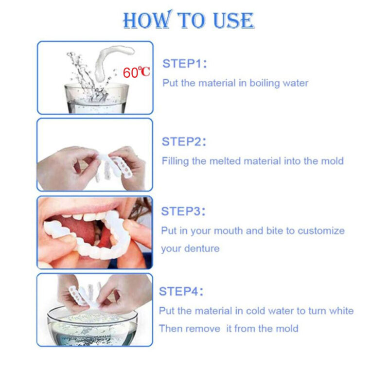 Snap On Dental Veneers
